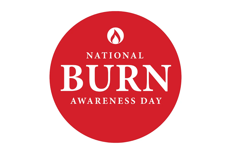 national burn awareness day